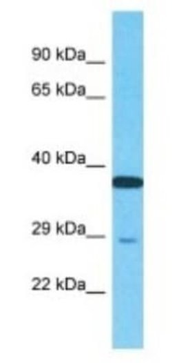 NUPL2 Rabbit anti-Human, Polyclonal, Novus Biologicals 100 &mu;g; Unconjugated:Antibodies,